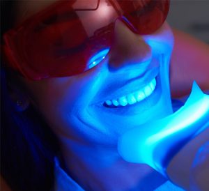 cosmetic teeth whitening