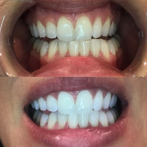 Teeth 3