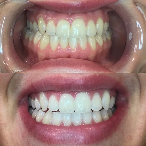 Teeth 5