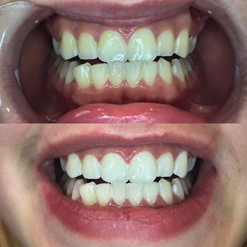 Teeth 6