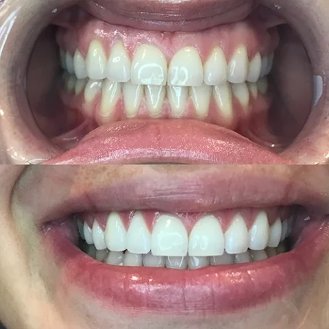 Teeth 7