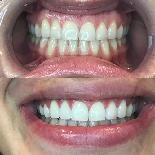 Teeth 7