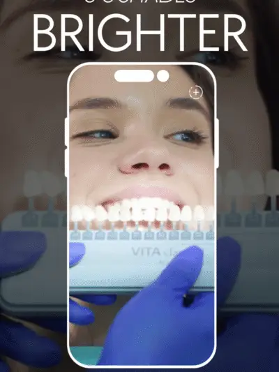 Copy-of-20PACK-Teeth-Whitening-Instagram-Reel-Videos-1-1000x1778 (1)