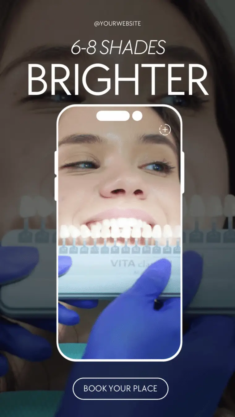 Copy-of-20PACK-Teeth-Whitening-Instagram-Reel-Videos-1-1000x1778 (1)