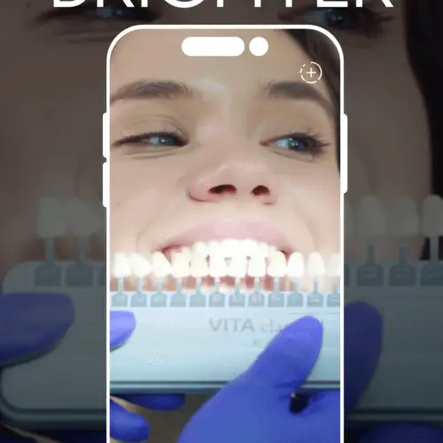 Copy-of-20PACK-Teeth-Whitening-Instagram-Reel-Videos-1-500x500 (1)